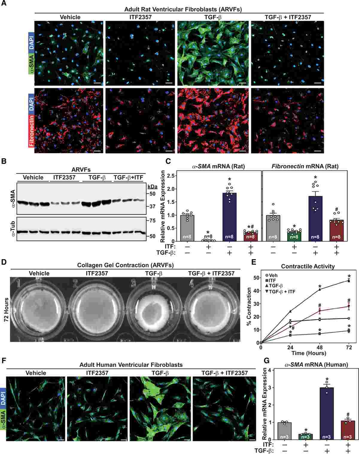 Histone deacetylase (HDAC) inhibition suppresses transforming growth factor–β (TGF-β)–induced cardiac fibroblast activation.