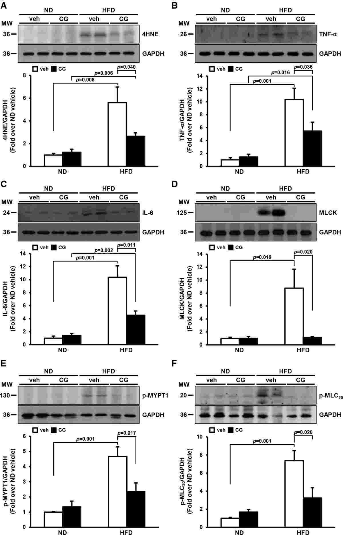 Effects of HDAC (histone deacetylase) inhibition on high-fat diet (HFD)–induced oxidative stress, inflammation, and vasoconstriction in the mesenteric arteries (MAs).