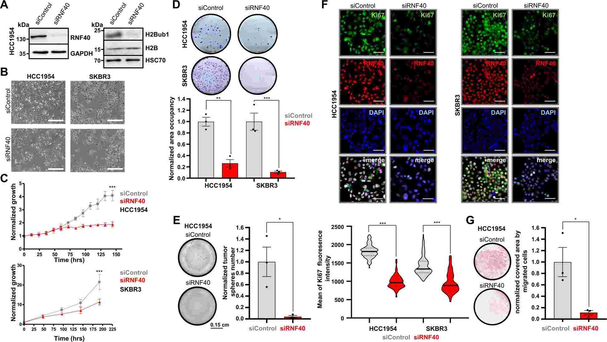 RNF40 loss impairs oncogenic properties of HER2-BC cells in vitro.