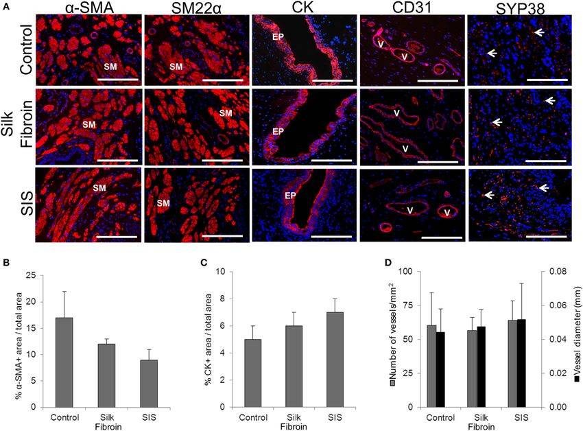 Urethral tissue regeneration following implantation of acellular silk fibroin scaffolds in rabbits.