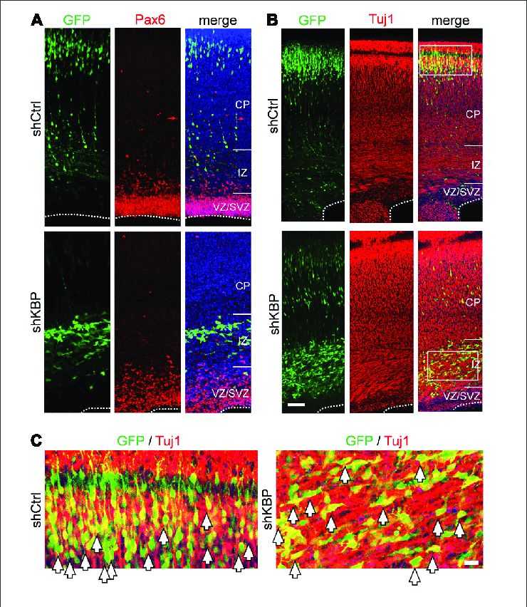 Neuronal lineage of transfected cells after IUE.