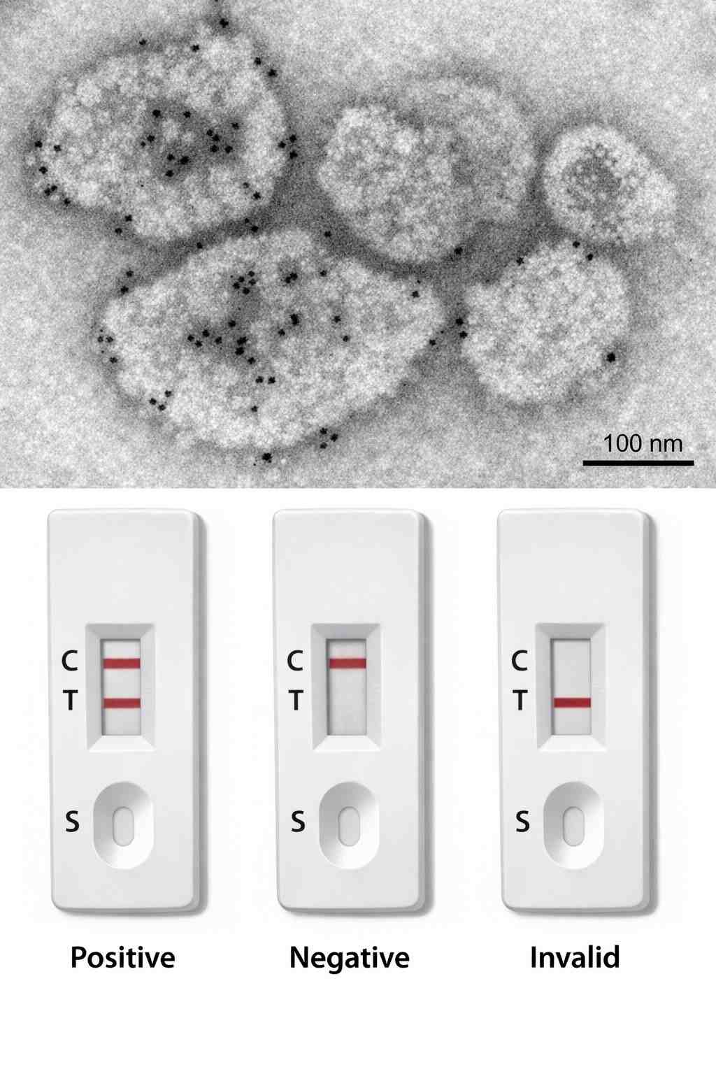 transmission-electron-micrograph-of-colloidal-gold-labeled-niv-n-protein