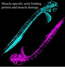 A Potential Way to Measure Injury with the Help of Protein Xin